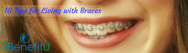 10 Tips for Living with Braces